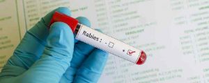 Dangers Of Rabies